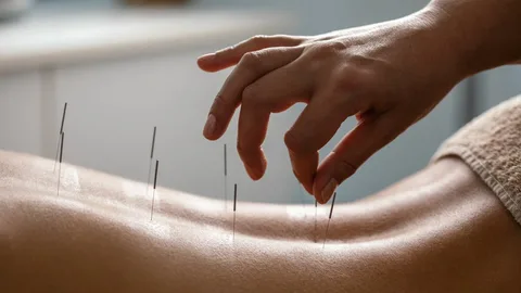 Healing Naturally: What to Expect at a Modern Clinic of Acupuncture